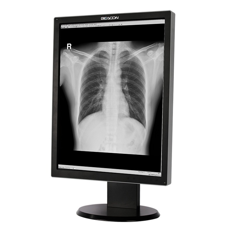 Монитор диагностический G22S Plus черно-белый